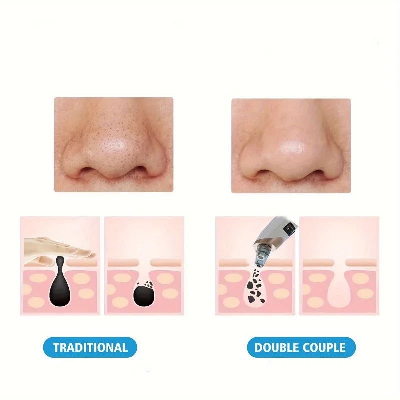 Blackhead Remover Pore Vacuum USB Rechargeable 5 Suction Levels Facial Pore Cleaner Kit for Adult Acne Extraction Tool